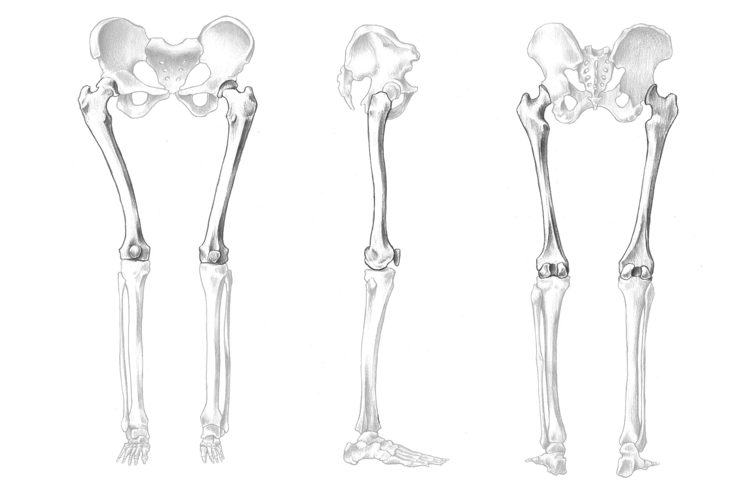 大腿骨の位置